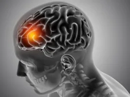 Τι είναι το ανεύρυσμα εγκεφάλου που υπέστη ο Γιώργος Μυλωνάκης – Πώς αντιμετωπίζεται