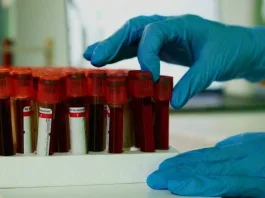 «Παντοτινά χημικά» βρέθηκαν στο 98,8% χιλιάδων δειγμάτων ανθρώπινου αίματος